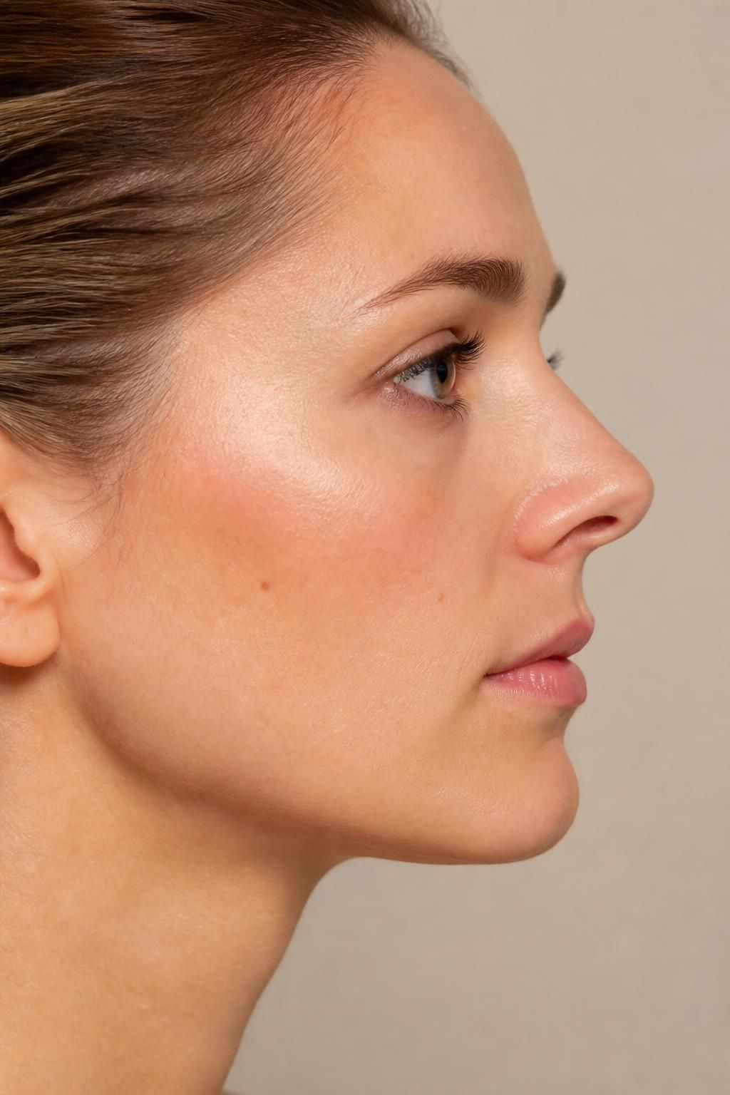 découvrez les différentes solutions pour corriger un nez en trompette, une particularité esthétique qui peut être harmonisée grâce à des techniques adaptées de chirurgie ou de médecine esthétique.